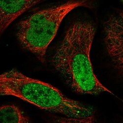 KLF5 Antibody, Novus Biologicals 0.1mL; Unlabeled:Antibodies, Polyclonal